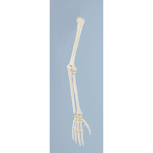 Skeleton of Arm - Erler Zimmer