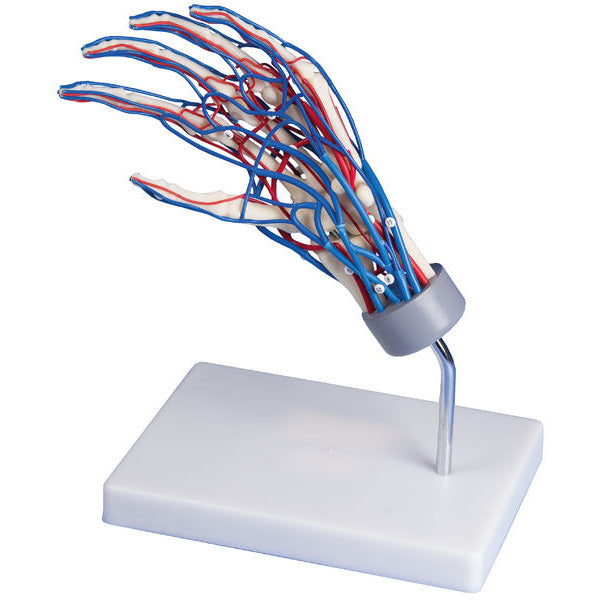 Vascular Hand - Erler Zimmer