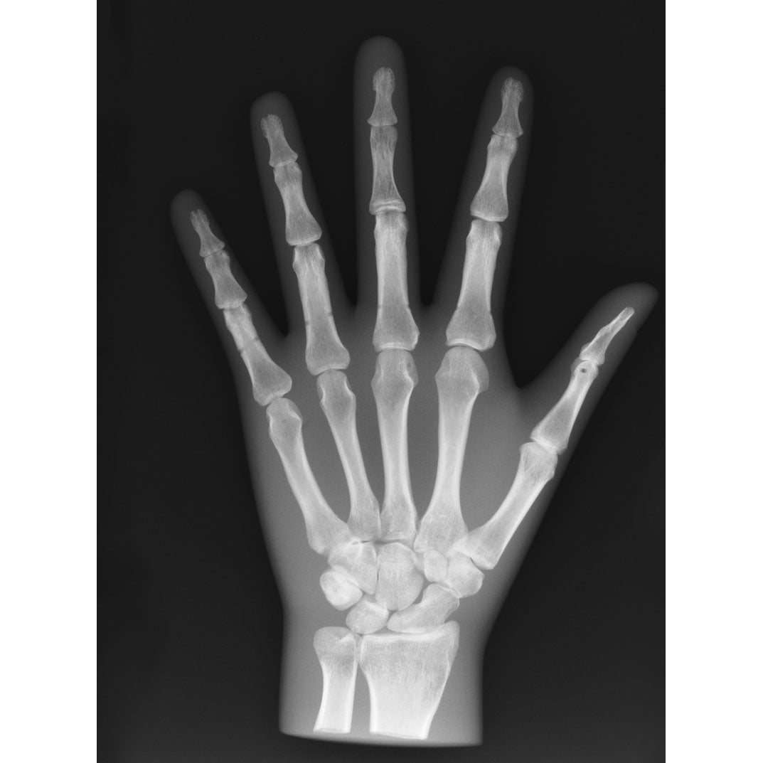 X-Ray Phantom Hand - Opaque