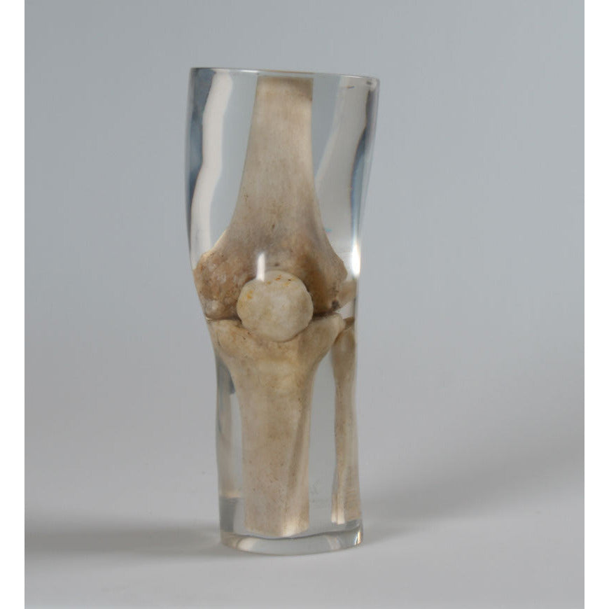 X-Ray Phantom Knee - Transparent
