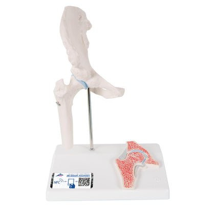 Mini Human Hip Joint Model with Cross Section - 3B Scientific