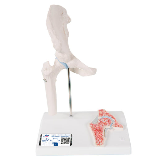 Mini Human Hip Joint Model with Cross Section - 3B Scientific