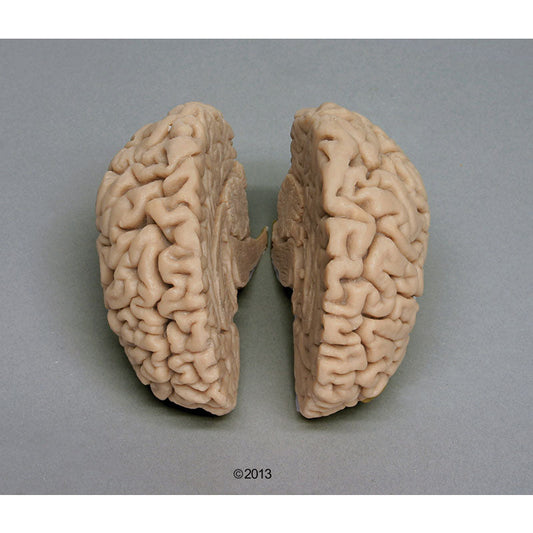 Human Brain - Actual Cast (For Female Skull) - Erler Zimmer