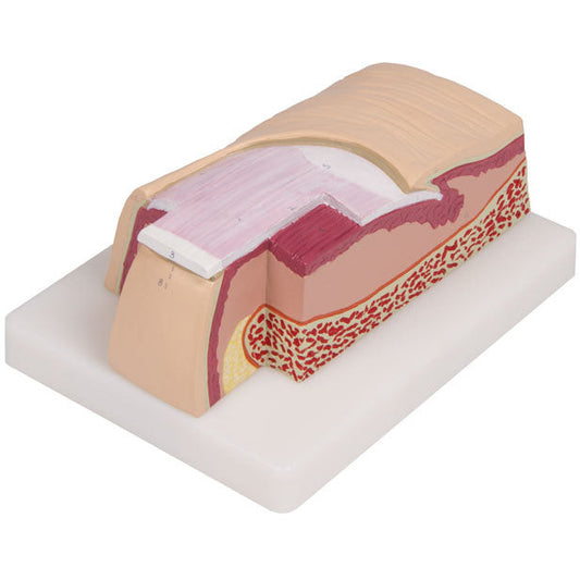 Nail Model - 5 Times Full Size - Erler Zimmer