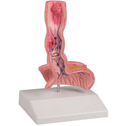Oesophagus Diseases - Erler Zimmer