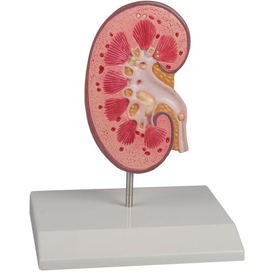 Kidney Stone Model - Erler Zimmer