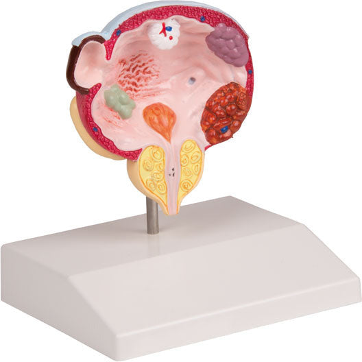 Diseases of Bladder & Prostate - Erler Zimmer