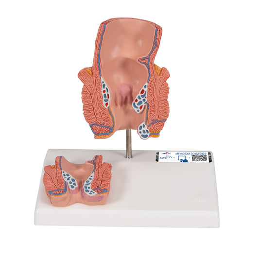 Hemorrhoid Model - 3B Scientific