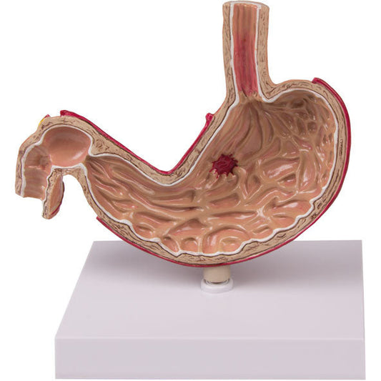 Stomach Model - Life-Size - Erler Zimmer