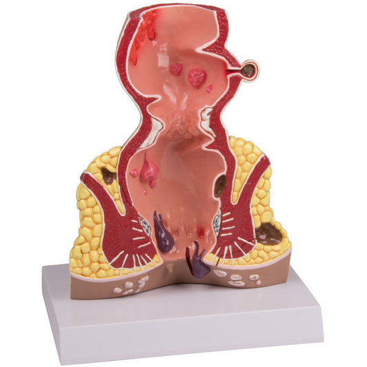 Rectum - 1.5 Times Life-Size - Erler Zimmer