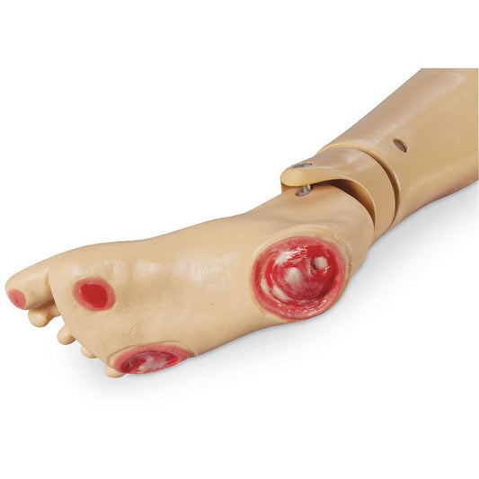 Pressure Ulcer Foot for GERI/KERI - Erler Zimmer