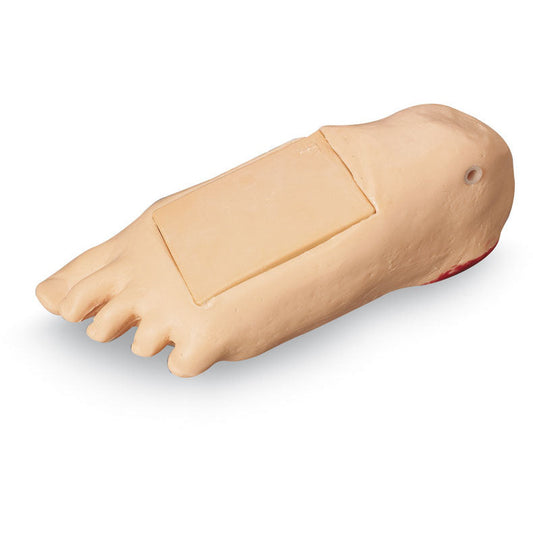 Edema Foot with Deep Tissue Injury for GERI/KERI - Erler Zimmer