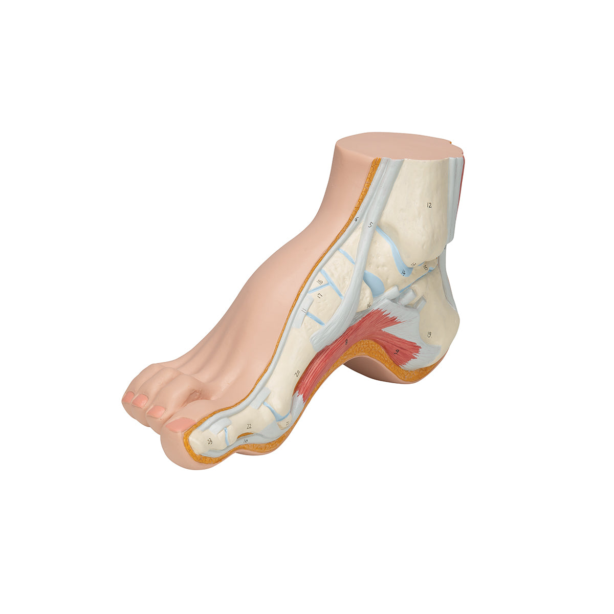 Hollow Foot (Pes Cavus) Model - 3B Scientific