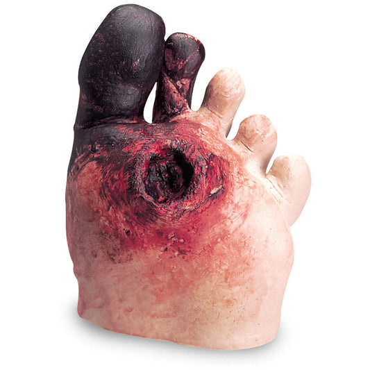 Unhealthy Foot Model - Erler Zimmer