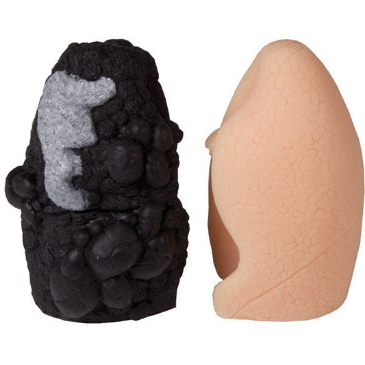 Lung Cancer Comparison Model - Health Edco