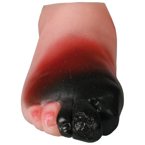 Diabetic Foot Model - Severe Stage - Erler Zimmer