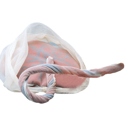 Model of Placenta & Umbilical Cord - Health Edco