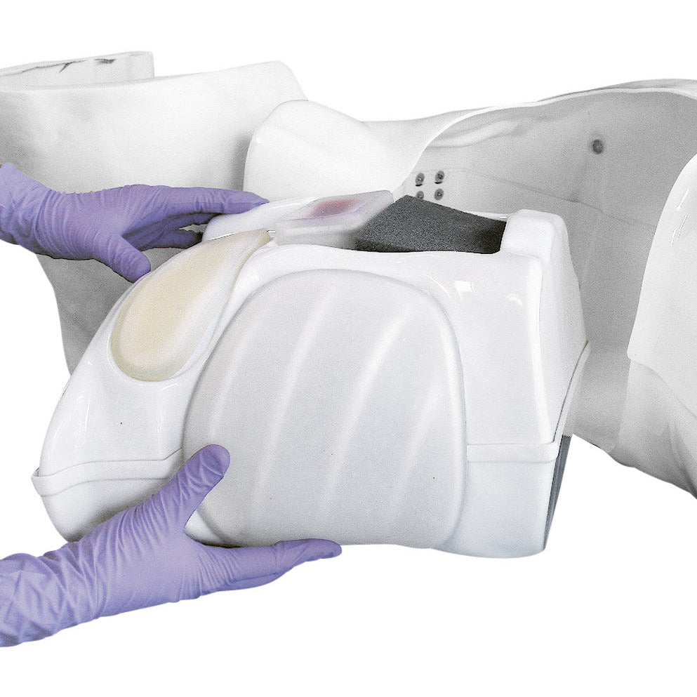 Pleura Aspiration Effusion Kit for R10078 - Erler Zimmer