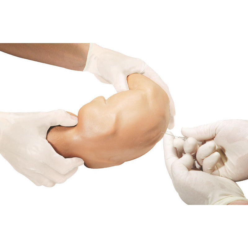 Baby Stap - Erler Zimmer