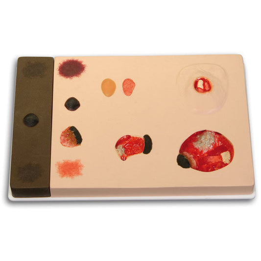 Pat Pressure Ulcer Staging Model - Erler Zimmer