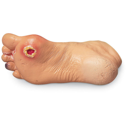 Advanced Foot Problems - Erler Zimmer