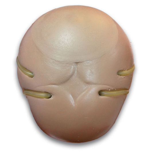 Temporal Venous Access Sites for R17700 - Erler Zimmer