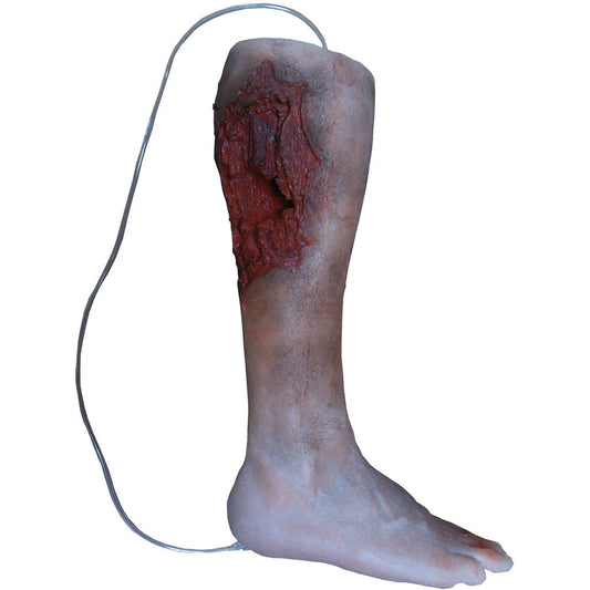 Emergency lower Leg - Erler Zimmer