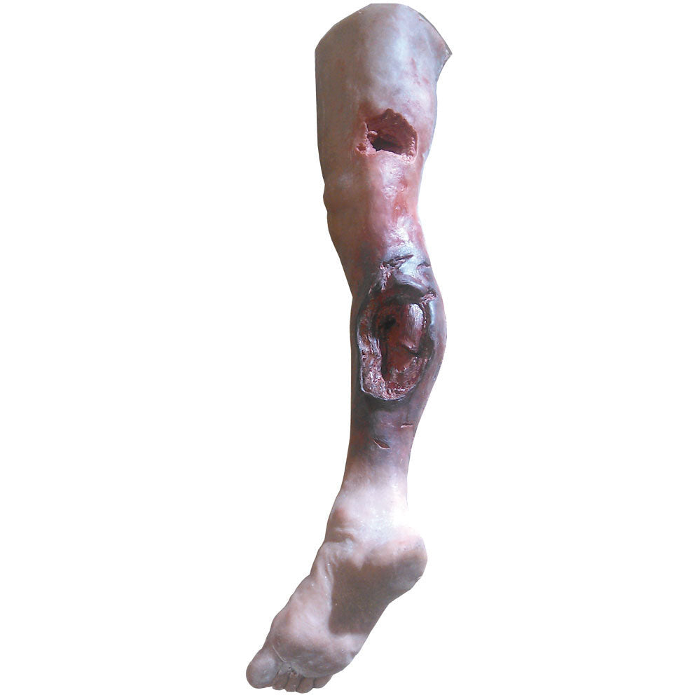 Emergency Leg - Erler Zimmer