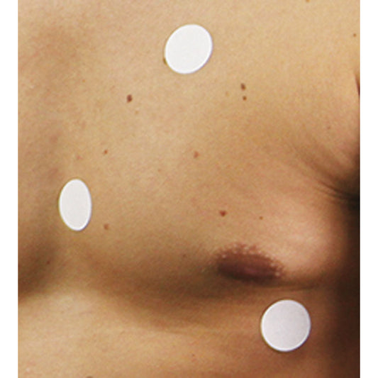 Replacement patches (15 pcs) for R60005 - Erler Zimmer