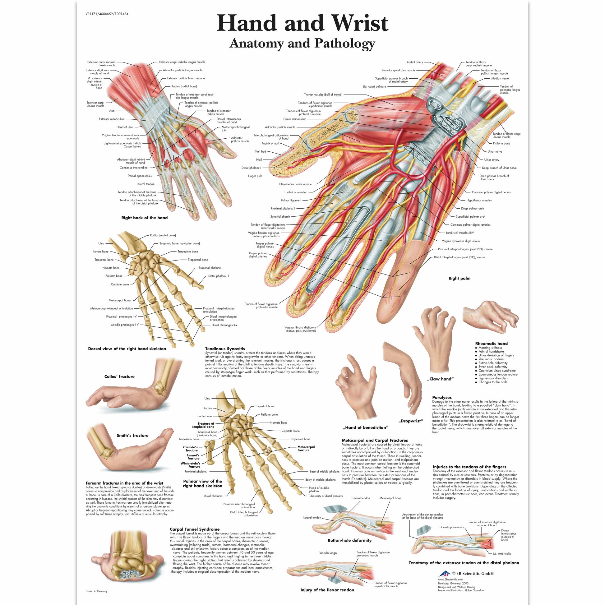Hand and Wrist Chart - 3B Scientific
