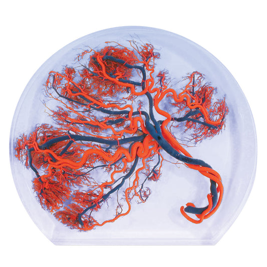 Placenta Model - 3B Scientific