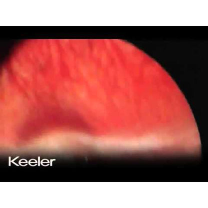Keeler Vantage Plus Indirect LED Binocular Ophthalmoscope