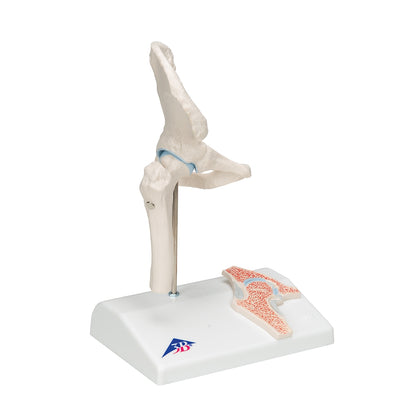 Mini Human Hip Joint Model with Cross Section - 3B Scientific