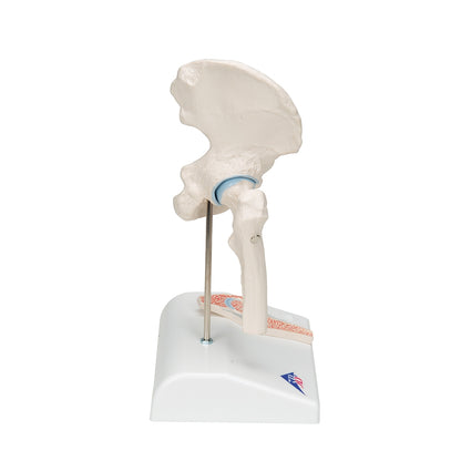 Mini Human Hip Joint Model with Cross Section - 3B Scientific