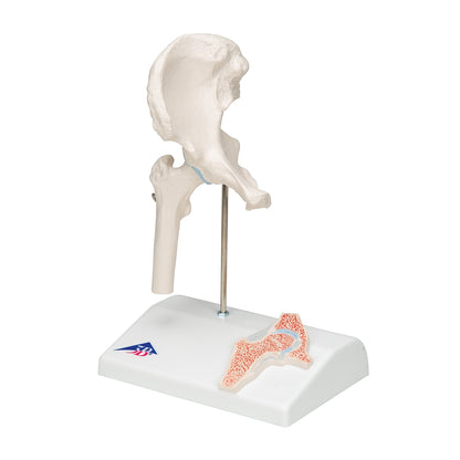 Mini Human Hip Joint Model with Cross Section - 3B Scientific