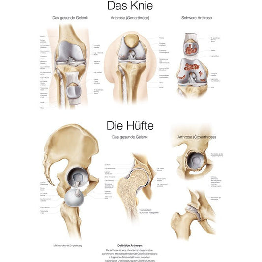 The Knee and The Hip - Small Poster