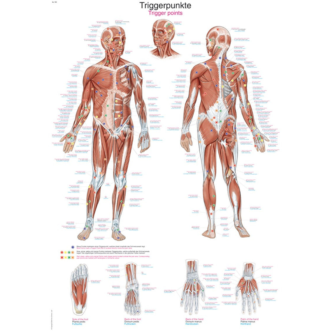 Trigger Points on the Body - Poster