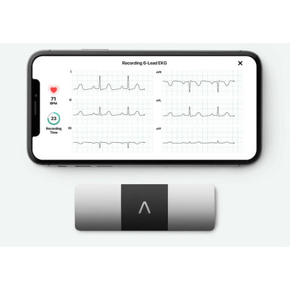 AliveCor KardiaMobile ECG 6 Lead - AliveCor