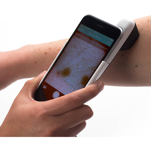 DermLite HUD Patient - Schuco