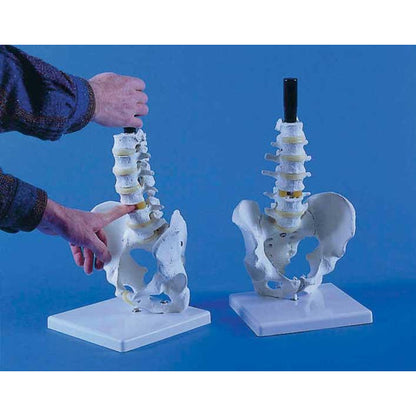 Lumbar Vertebrae with Pelvis on Stand