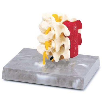 Lumbar Vertebrae With Muscle