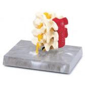 Lumbar Vertebrae With Muscle