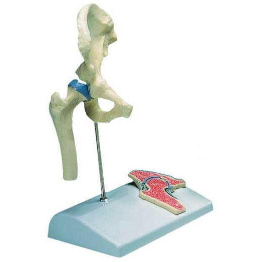Miniature Hip Joint Model