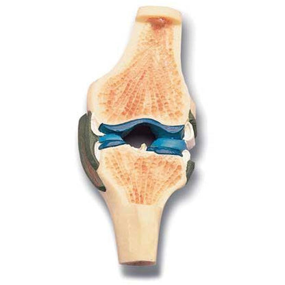 Longitudinal Section - Model Knee