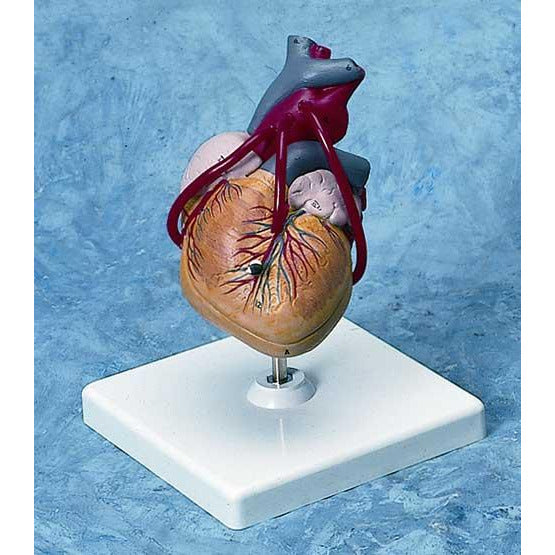 Heart Model with Bypass