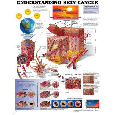 Poster: Understanding Skin Cancer