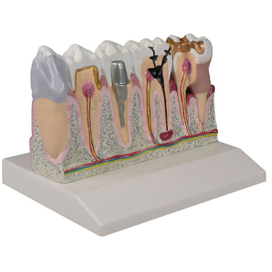 Dental Model - 4 Times Life-Size