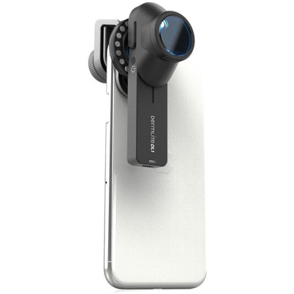 DERMLITE DL1 Dermatoscope - Schuco