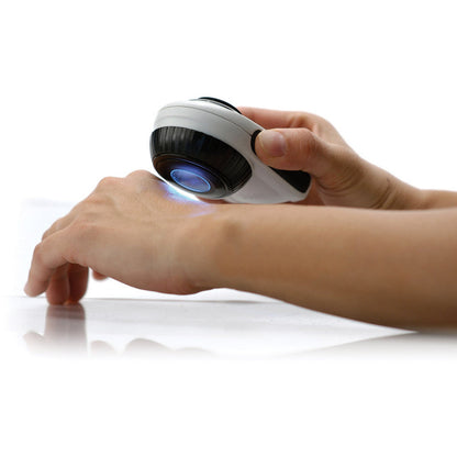 Dermlite II Fluid Dermatoscope
