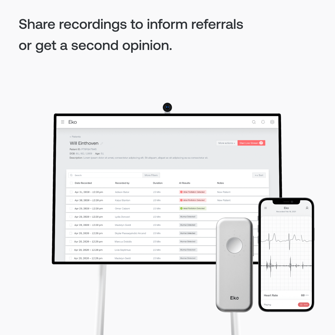 Eko DUO Digital Electronic Stethoscope and ECG with Bluetooth - Eko